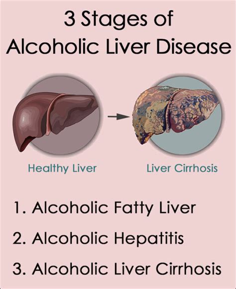 Chronic liver damage result of alcoholism .